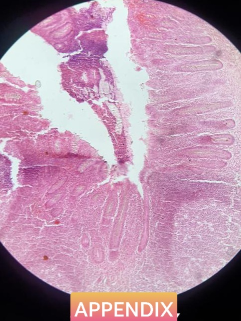 appendix histology slide for mbbs 1st year