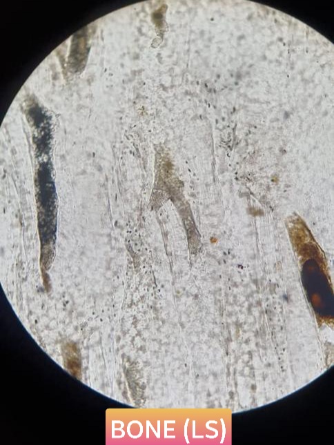bone ls histology slide for 1st year mbbs