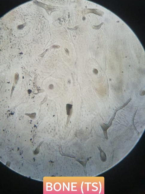 bone ts histology slide for 1st year mbbs