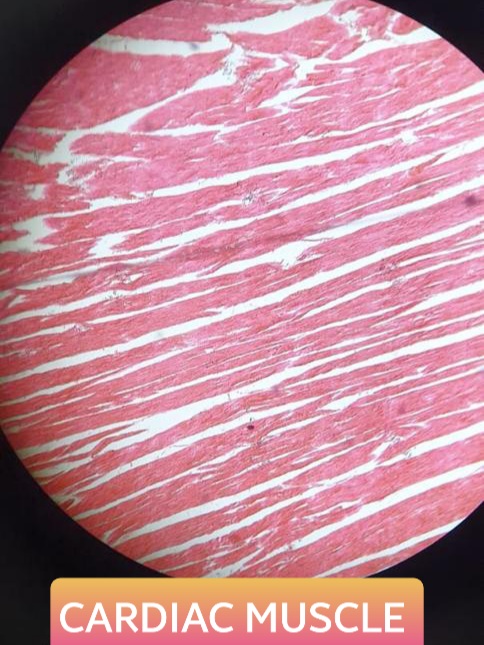 cardiac muscle histology slide for 1st year mbbs