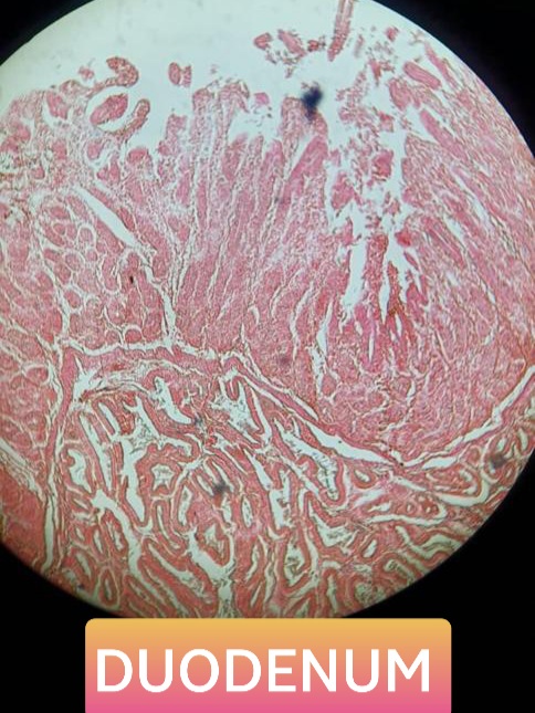 duodenum histology slide for mbbs 1st year