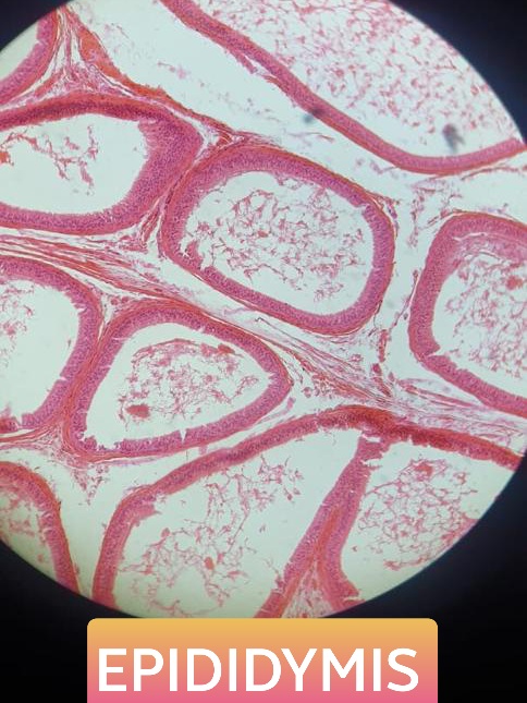 epididymis histology slide for mbbs 1st year