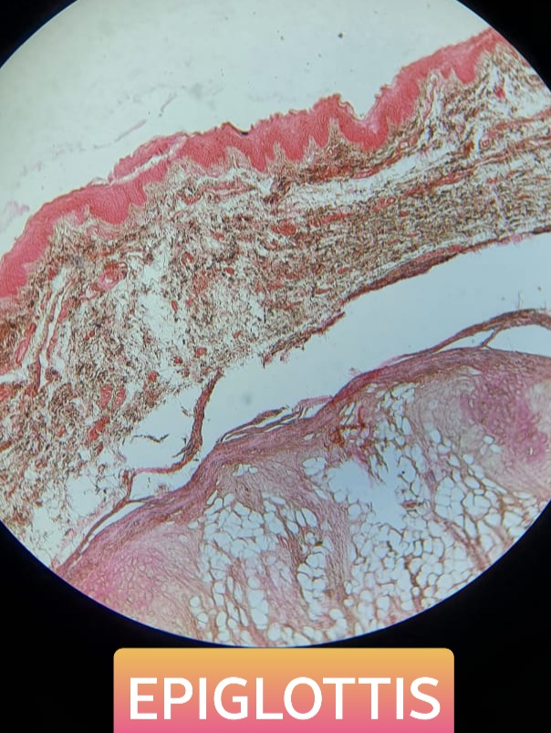epiglottis histology slide for mbbs 1st year