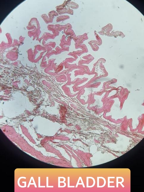gall bladder histology slide for mbbs 1st year