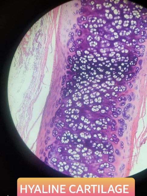hyaline cartilage histology slide for 1st year mbbs