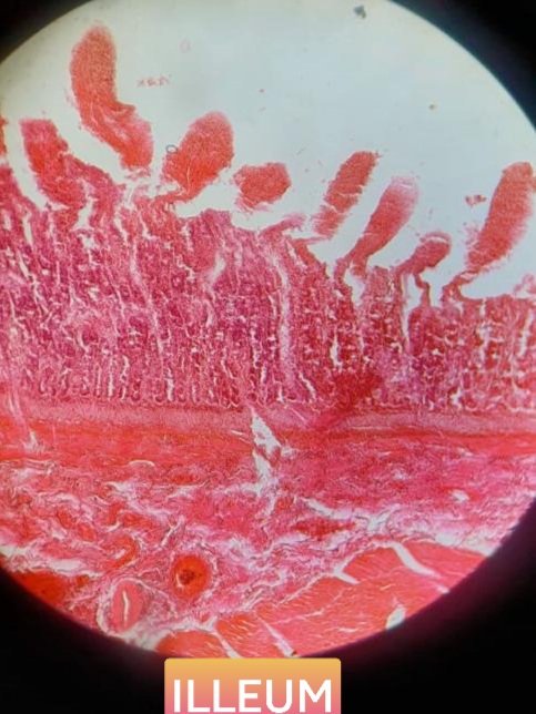 illeum histology slide for mbbs 1st year