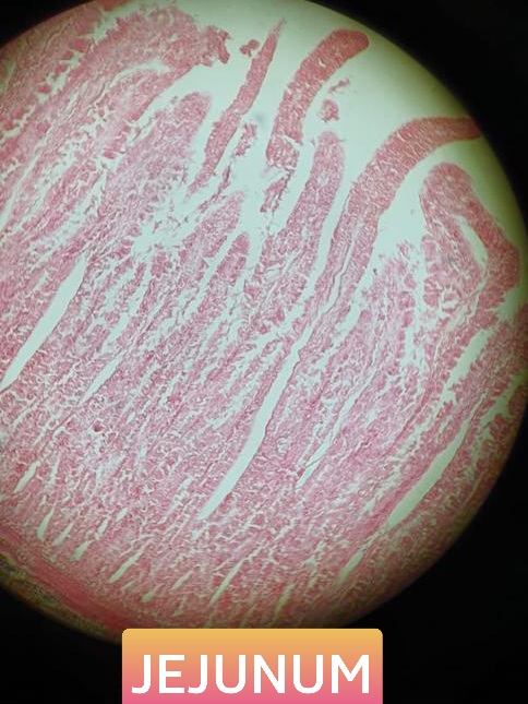 jejunum histology slide for mbbs 1st year