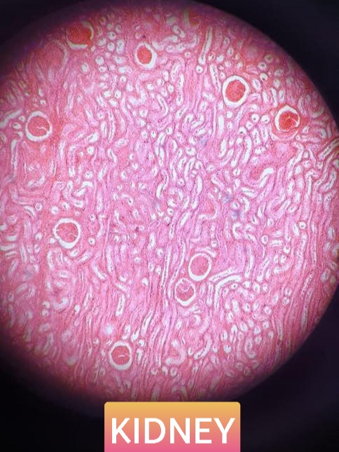 kidney histology slide for mbbs 1st year