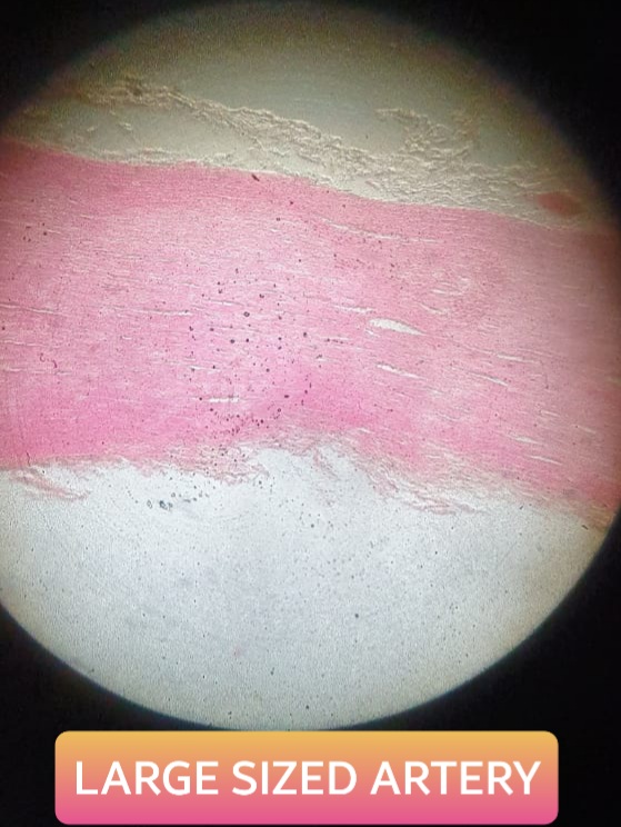elastic or large sized artery histology slide for mbbs 1st year