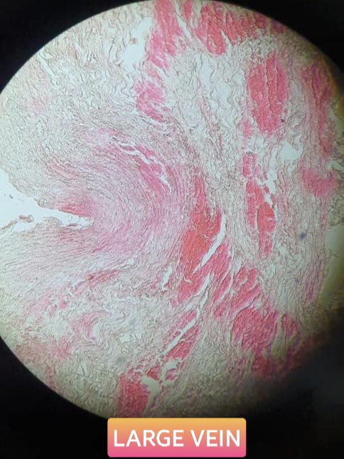 large vein histology slide for mbbs 1st year