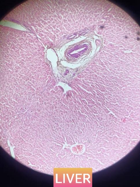 liver histology slide for mbbs 1st year