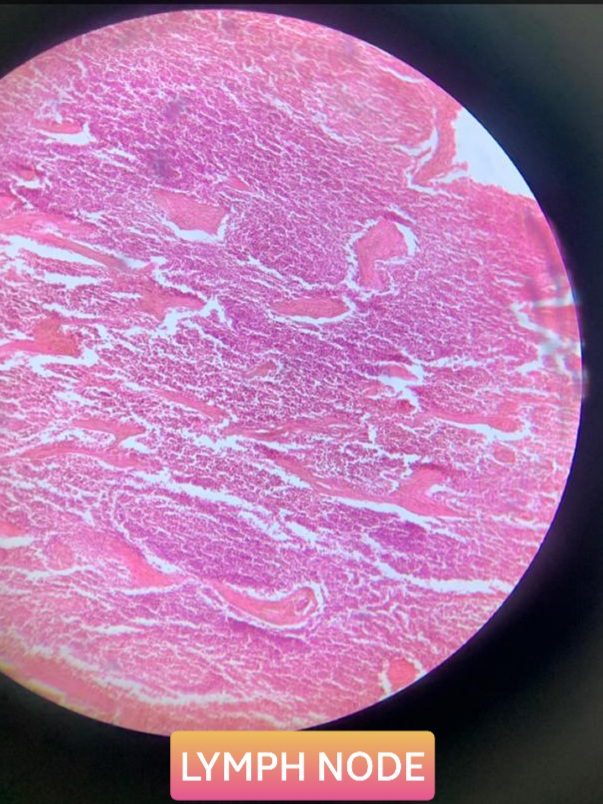 lymph node histology slide for mbbs 1st year
