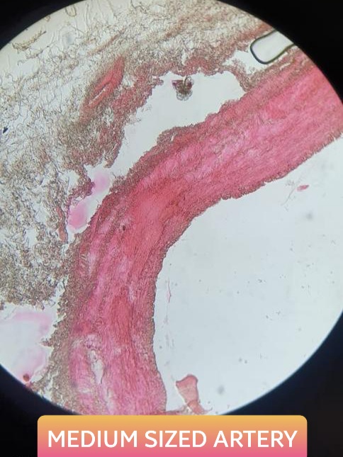 muscular or medium sized artery histology slide for mbbs 1st year