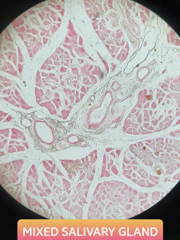 mixed salivary gland histology slide for mbbs 1st year