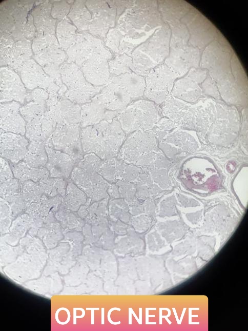 optic nerve histology slide for 1st year mbbs