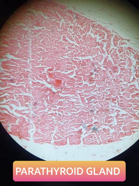 parathyroid gland histology slide for mbbs 1st year