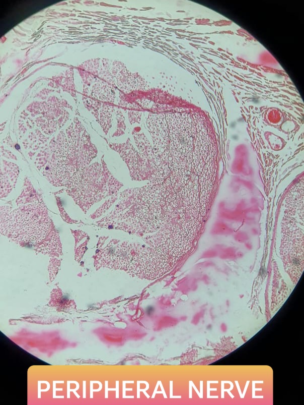 peripheral nerve histology slide for 1st year mbbs