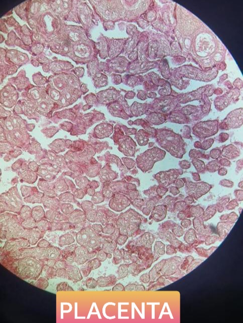placenta histology slide for mbbs 1st year