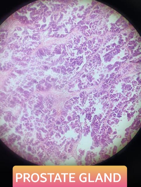 prostate gland histology slide for mbbs 1st year