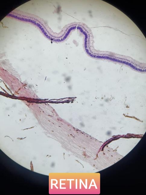 retina histology slide for mbbs 1st year