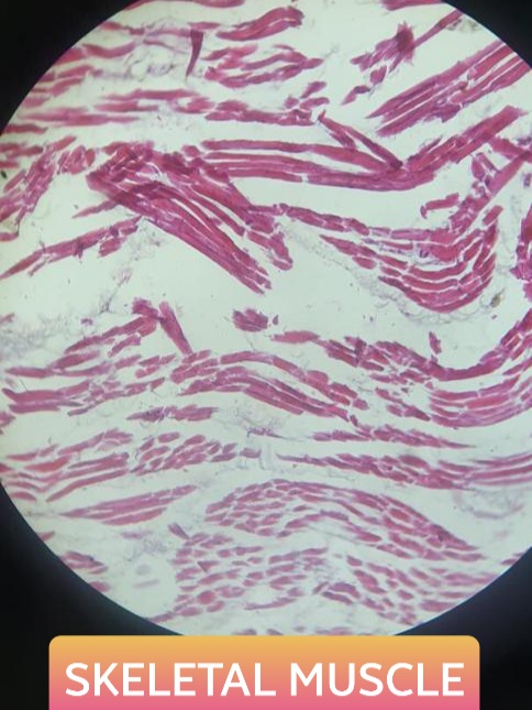 skeletal muscle histology slide for 1st year mbbs