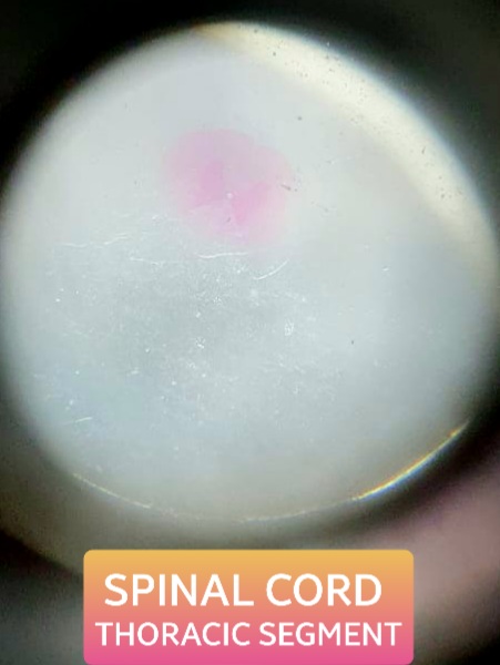 spinal cord histology slide for mbbs 1st year