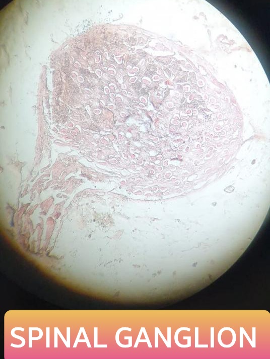 spinal ganglion histology slide for 1st year mbbs