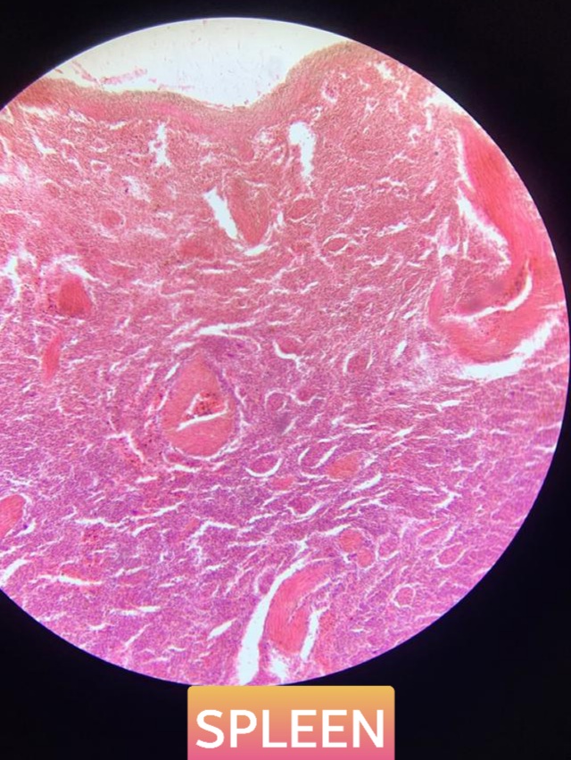 spleen histology slide for mbbs 1st year