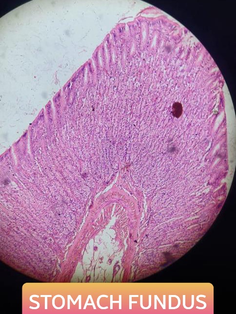 fundus of stomach histology slide for mbbs 1st year