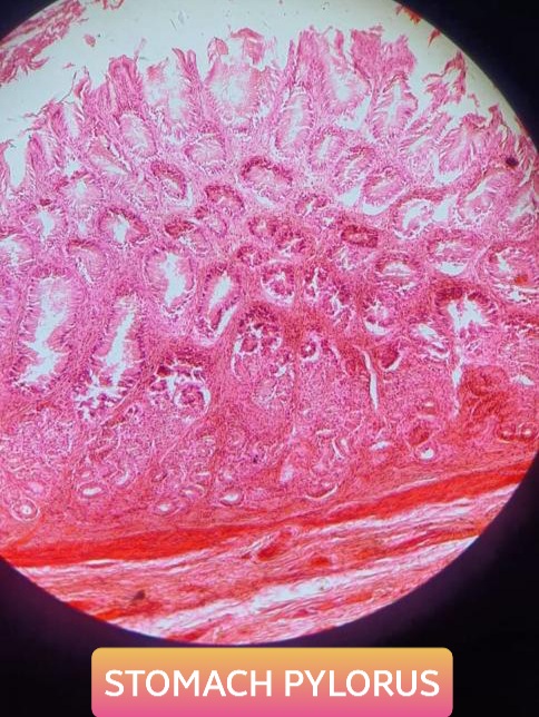 pylorus of stomach histology slide for mbbs 1st year