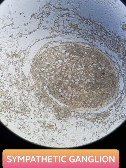 sympathetic ganglion histology slide for 1st year mbbs