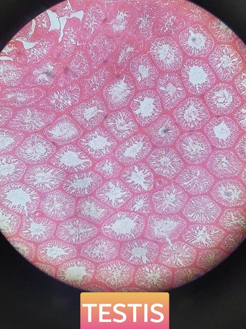 testis histology slide for mbbs 1st year