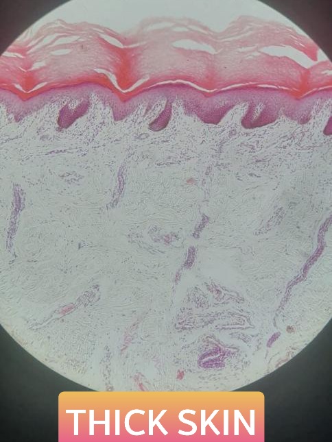 thick skin histology slide for mbbs 1st year