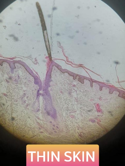 thin skin histology slide for mbbs 1st year