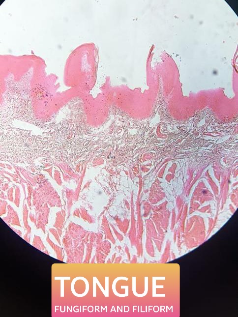 tongue fungiform filiform papillae histology slide for mbbs 1st year
