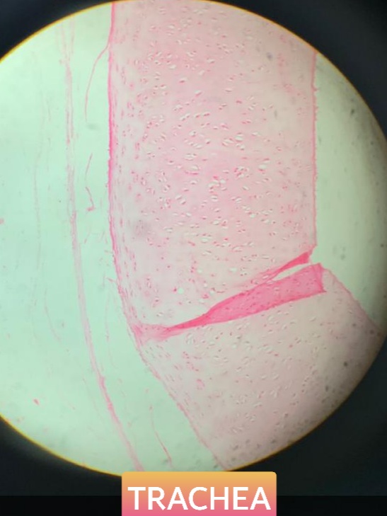 trachea histology slide for mbbs 1st year