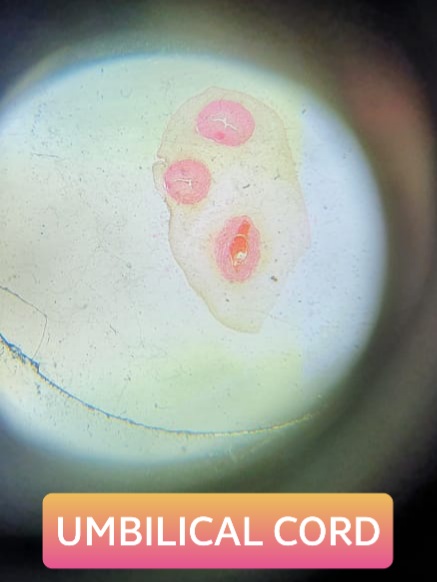 umbilical cord histology slide for mbbs 1st year