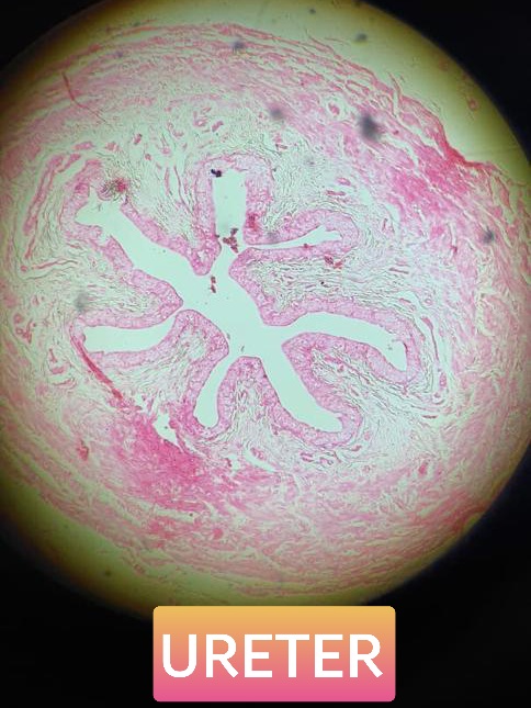 ureter histology slide for mbbs 1st year