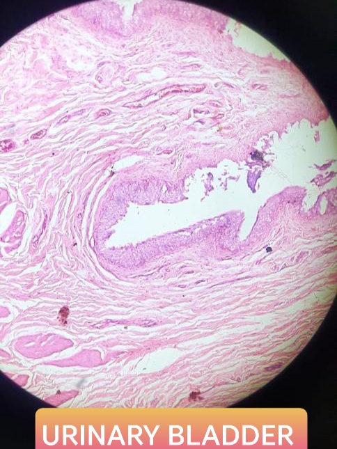 urinary bladder histology slide for mbbs 1st year