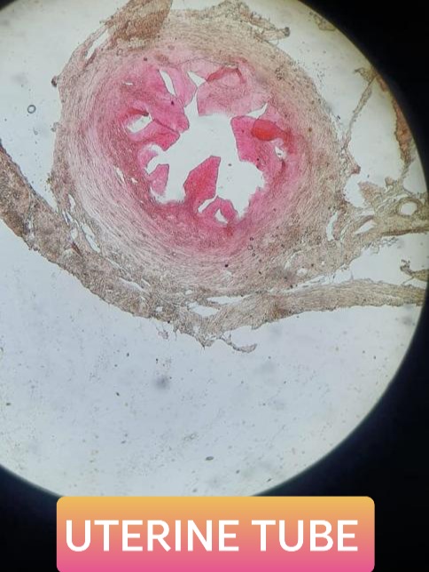 uterine or fallopian tube histology slide for mbbs 1st year