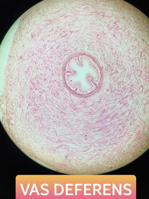 vas deferens histology slide for mbbs 1st year