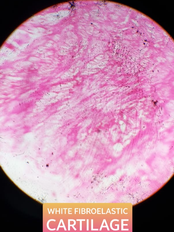 white fibrocartilage histology slide for 1st year mbbs